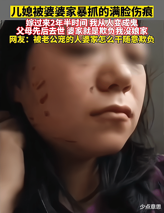 陕西:女子父母去世后,被家暴到满脸伤痕,2年半时间从人变成鬼