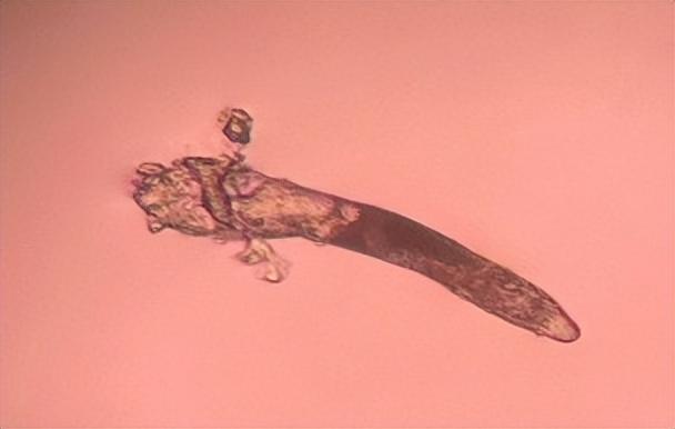 医生|眼睛又干又痒,睫毛都快掉光了!“元凶”竟然是它