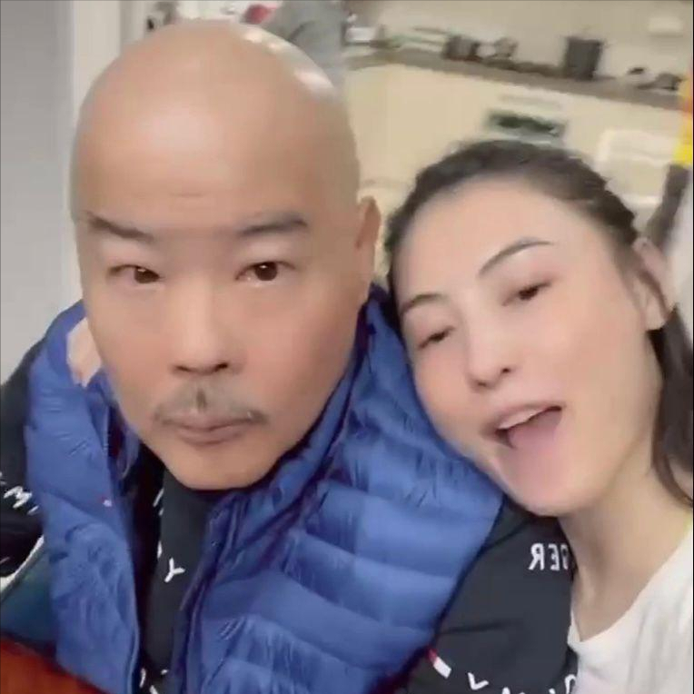 张柏芝|张柏芝被3岁小儿子抓伤脸部，伤口较长且深像刀疤一样遮都遮不住