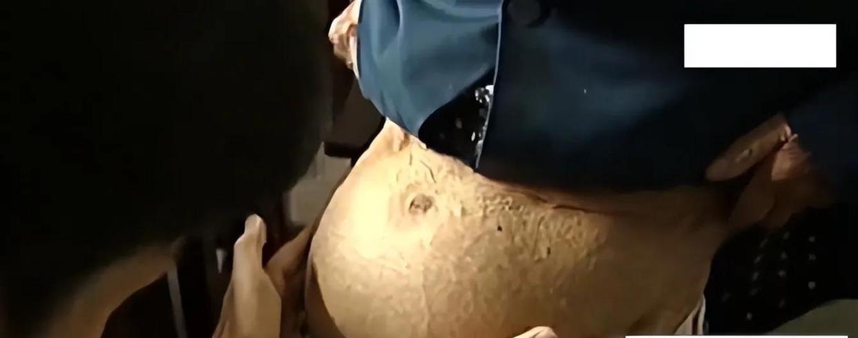 07年四川91岁老太摔一跤后，到医院竟查出怀孕，引出60年前秘密