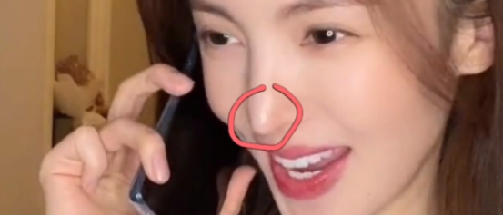 经典|坚持不承认整容的明星,看看对比图:别把观众当傻子