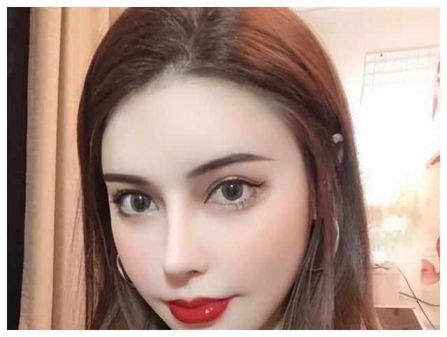 因整容走上颜值巅峰，没有出现过后遗症，如今美成整容模板
