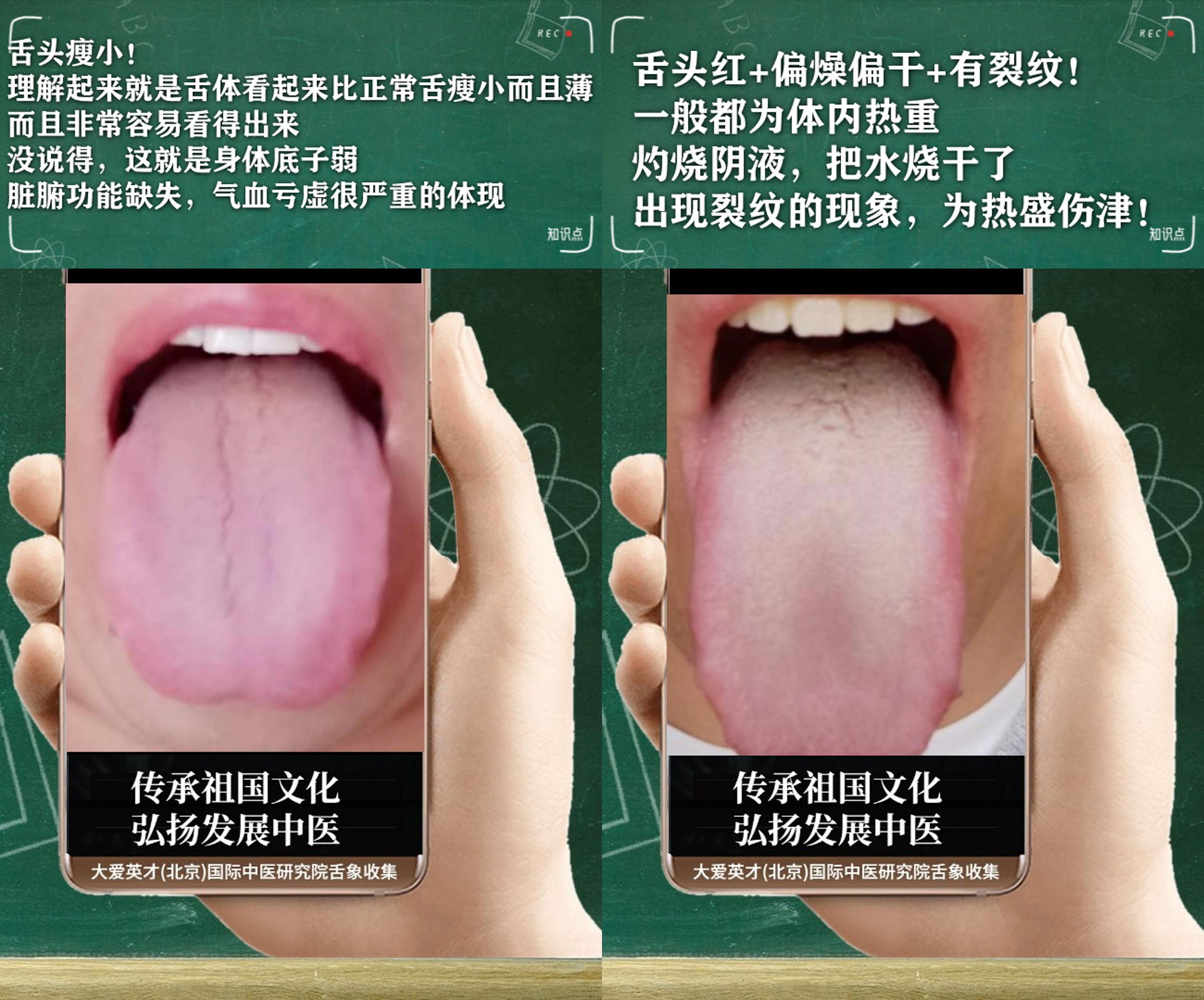 脾胃|中医实解：气短心悸，小便浑浊，大便不成形，寒湿凝滞