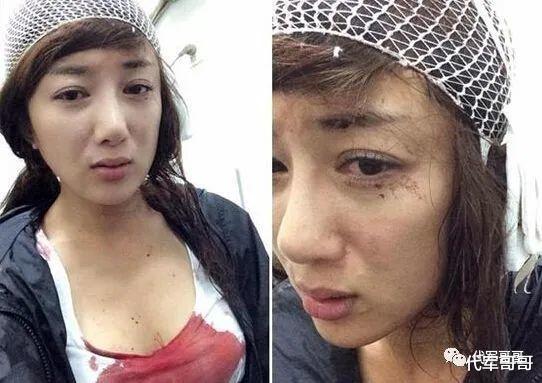 李依晓|“古装第一美人”李依晓：被狗咬到毁容，如今39岁还是孤身一人