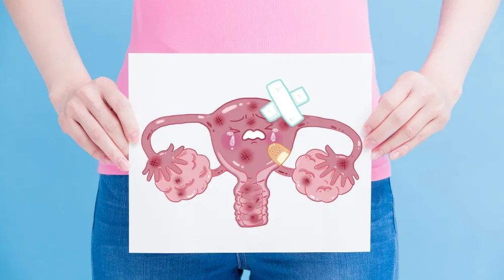 祛湿|这些妇科健康知识,建议女性朋友都要提前了解