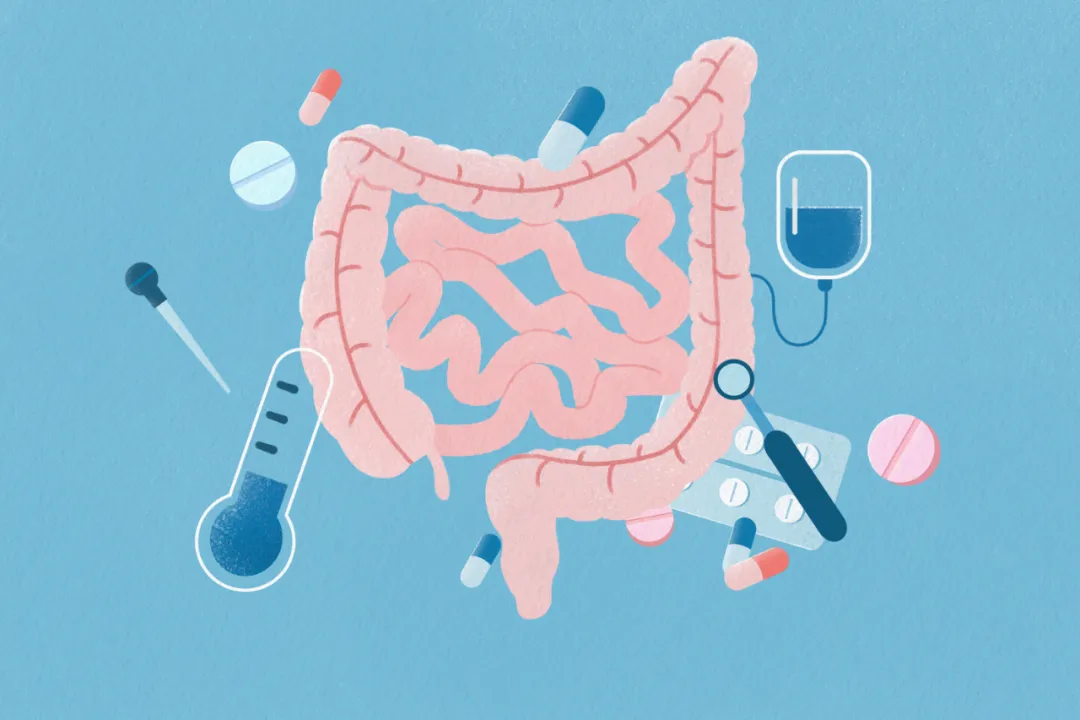 结直肠癌 专家说 | 20-30岁减肥，竟能降低这种癌症风险！