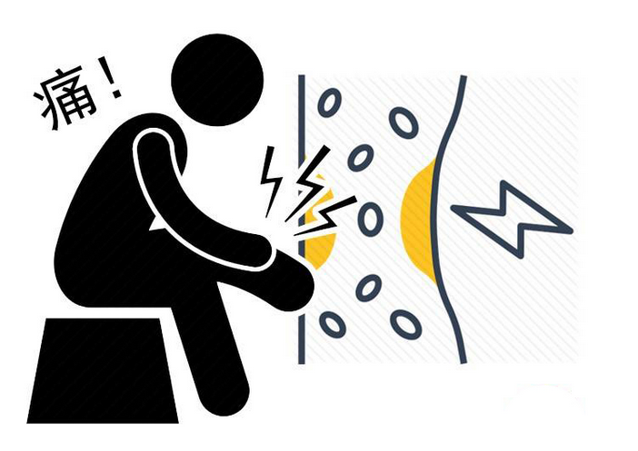 脾胃|体内有栓,腿部告知!腿部出现这些异常变化,要排查血栓捣鬼