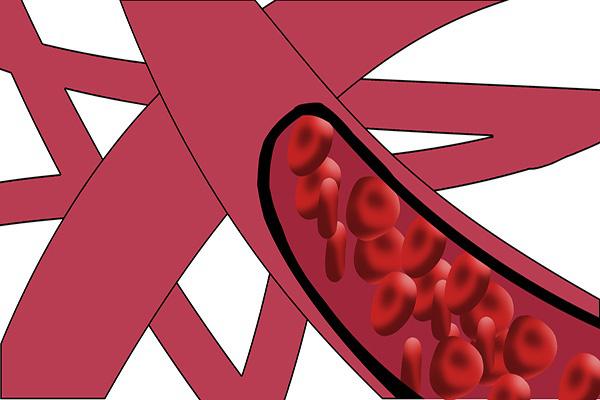 中药|血管越硬命越短!四种食物换着吃,软化血管,或能远离中风