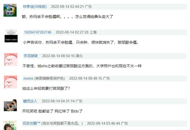 洪成成|洪成成被质疑“脸很僵”,本人坦言做过医美,网友:恐怕不止