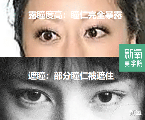 赵本山 眉眼走势是怎么影响颜值的?