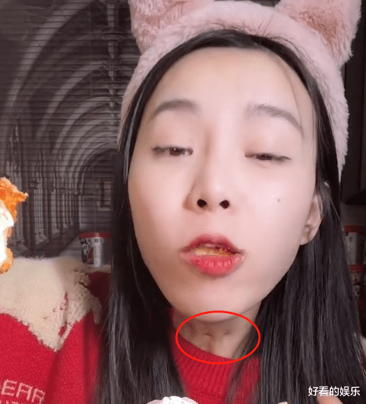 小贝|网红小贝饿了现状堪忧,手上有伤疤陷假吃风波,本人亲自下场辟谣