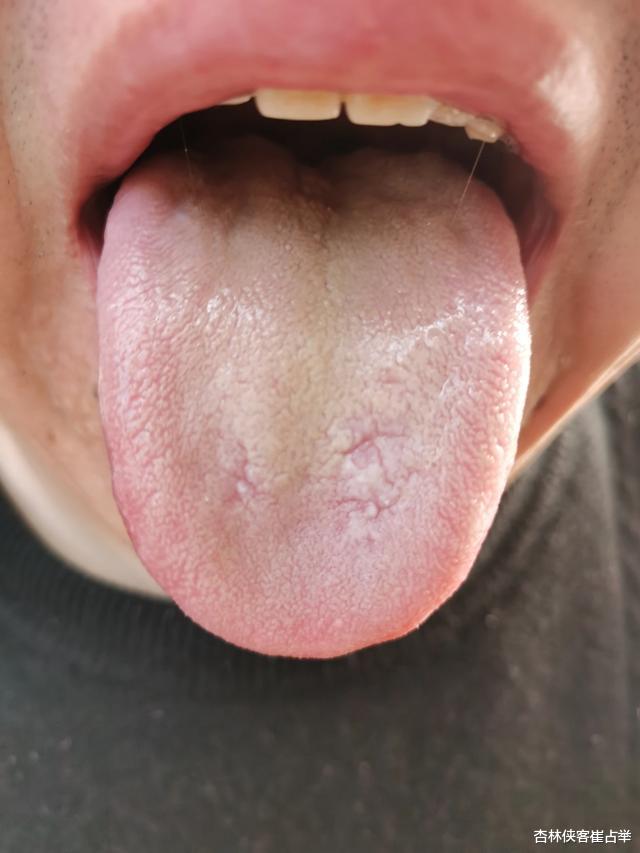 脾胃|腹胀、腹泻、乏力、萎黄?中医教你两个小妙招,让你把脾胃补起来