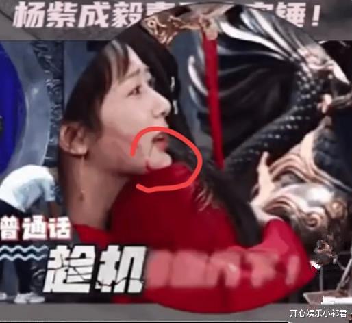 翁虹|继杨紫的鼻子被嘲变形后,她的下巴又被嘲了,下巴这样真的正常吗