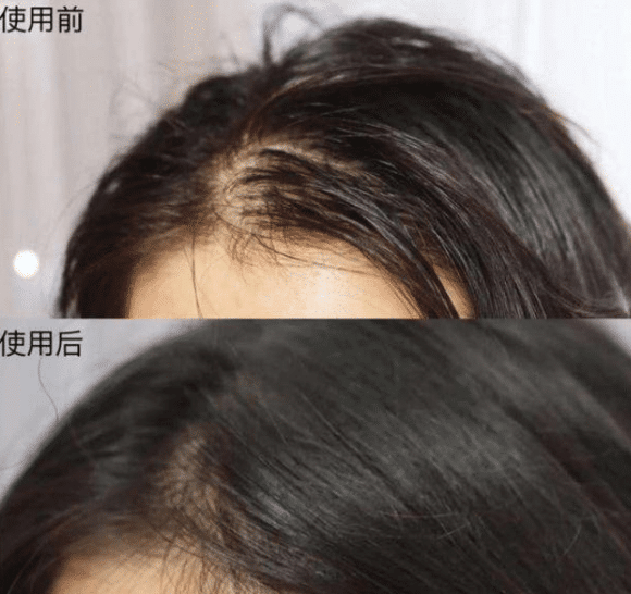 洗发水 ?超市洗发水遭“嫌弃”，年轻人为何宁愿选择新国货，也不用大品牌了？