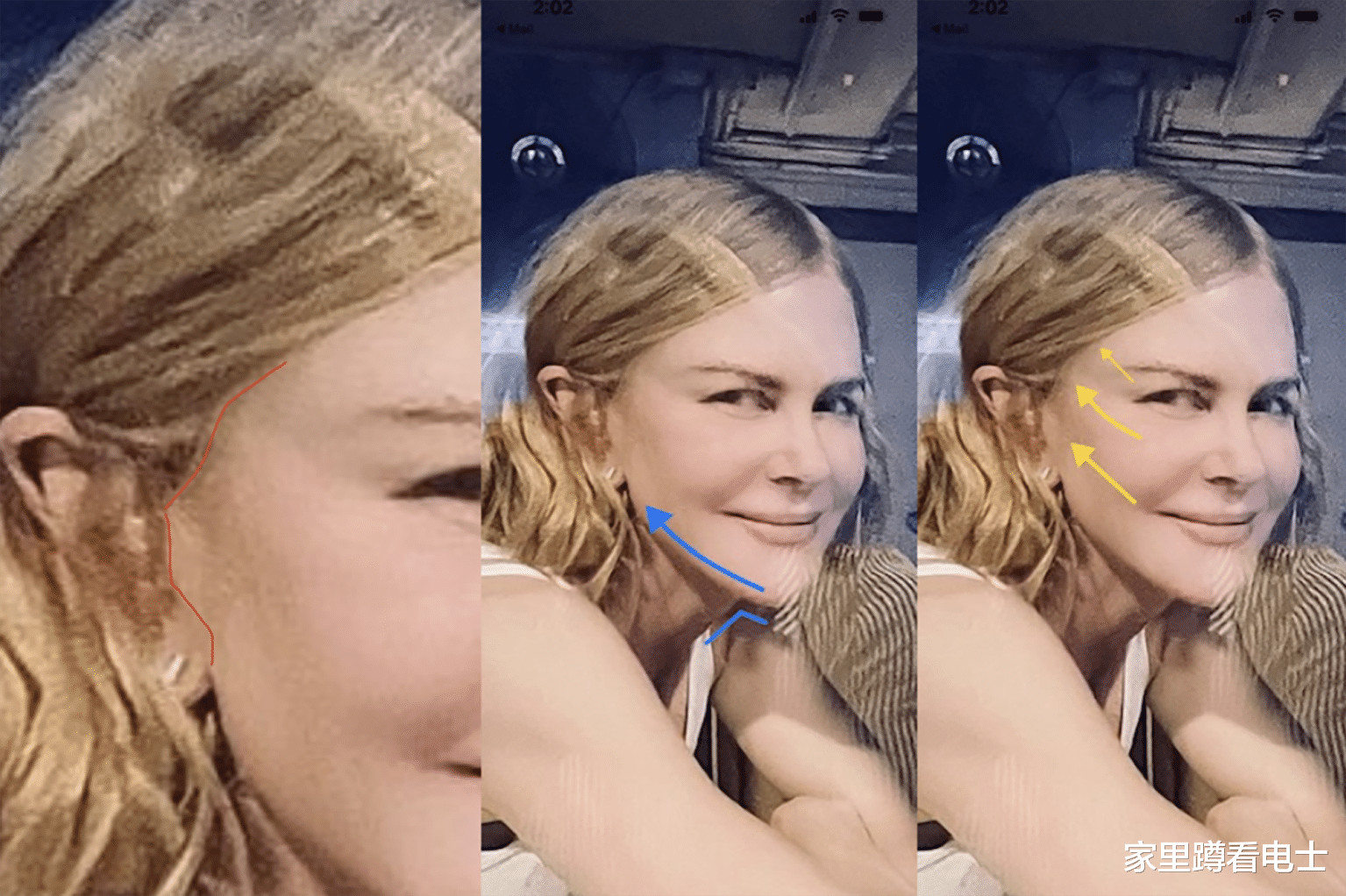 妮可·基德曼|妮可基德曼“变脸”，看着不像54岁，状态不如59岁的前夫阿汤哥