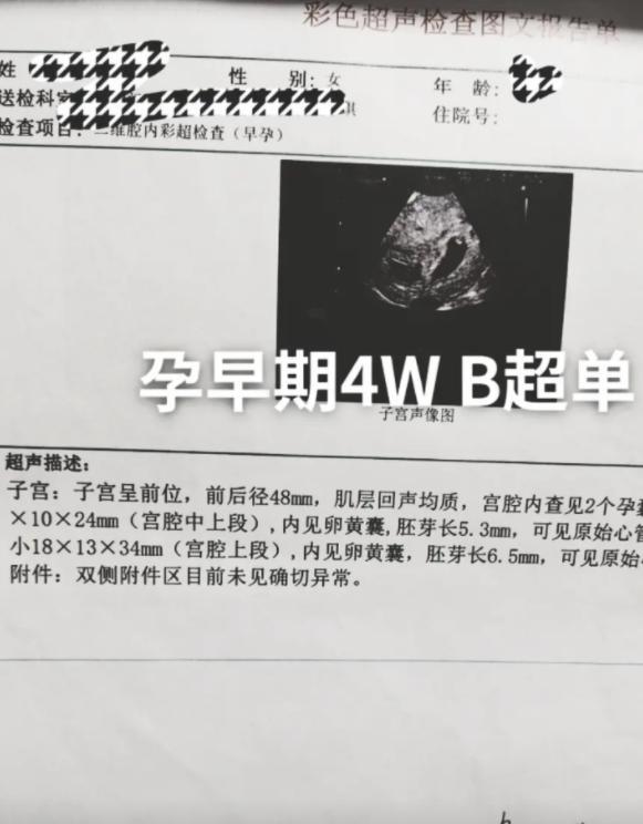 陈萌|陈萌晒产检单宣誓主权，大衣嫂全程陪同，网友：小看朱小伟了