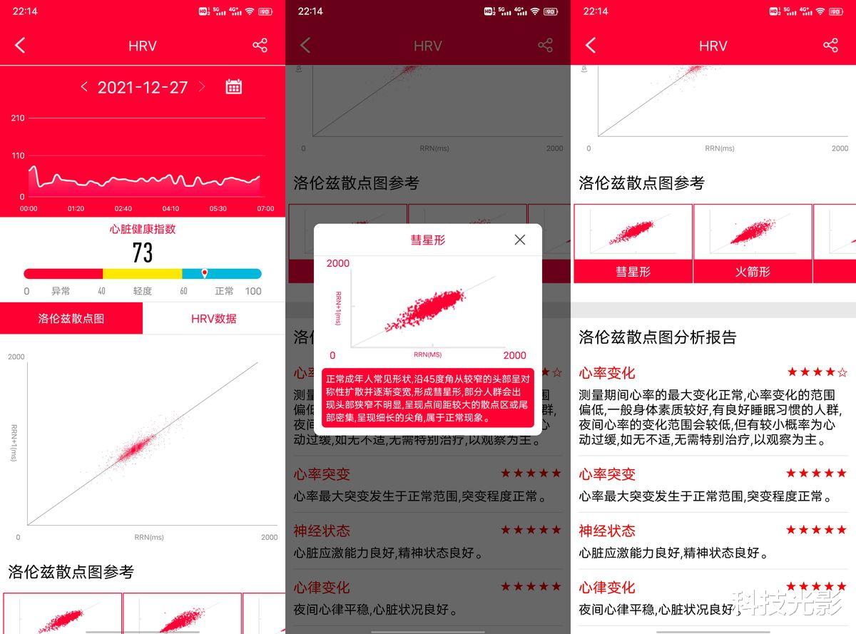 工业互联网|专注血氧心电图的手环体验评测：dido Y1智能手环
