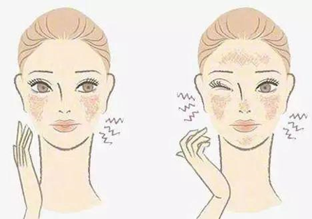 防晒|风很大的早C晚A公式+刷酸是什么?新手入门一定要看的超详细攻略