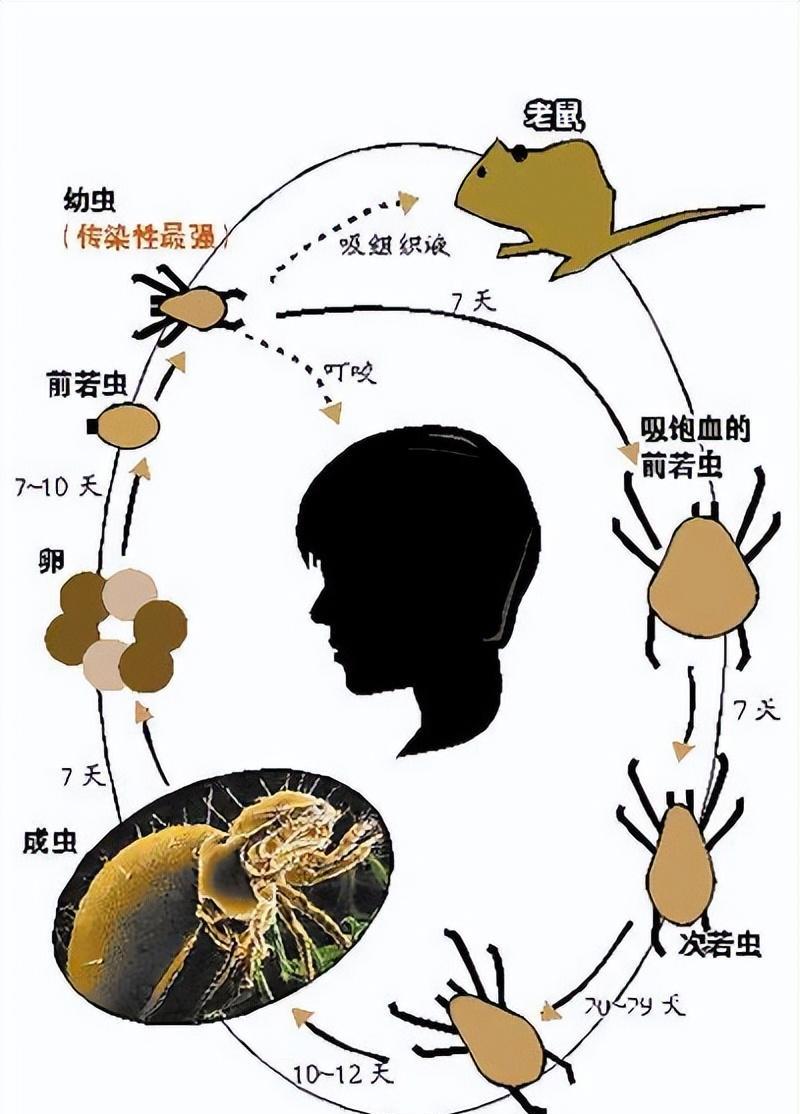 只因被咬一口:52岁大叔多器官衰竭!比蜱虫还毒?它究竟是何物种