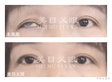 单眼又怎样,被小姐姐的乐观和洒脱整破防了!
