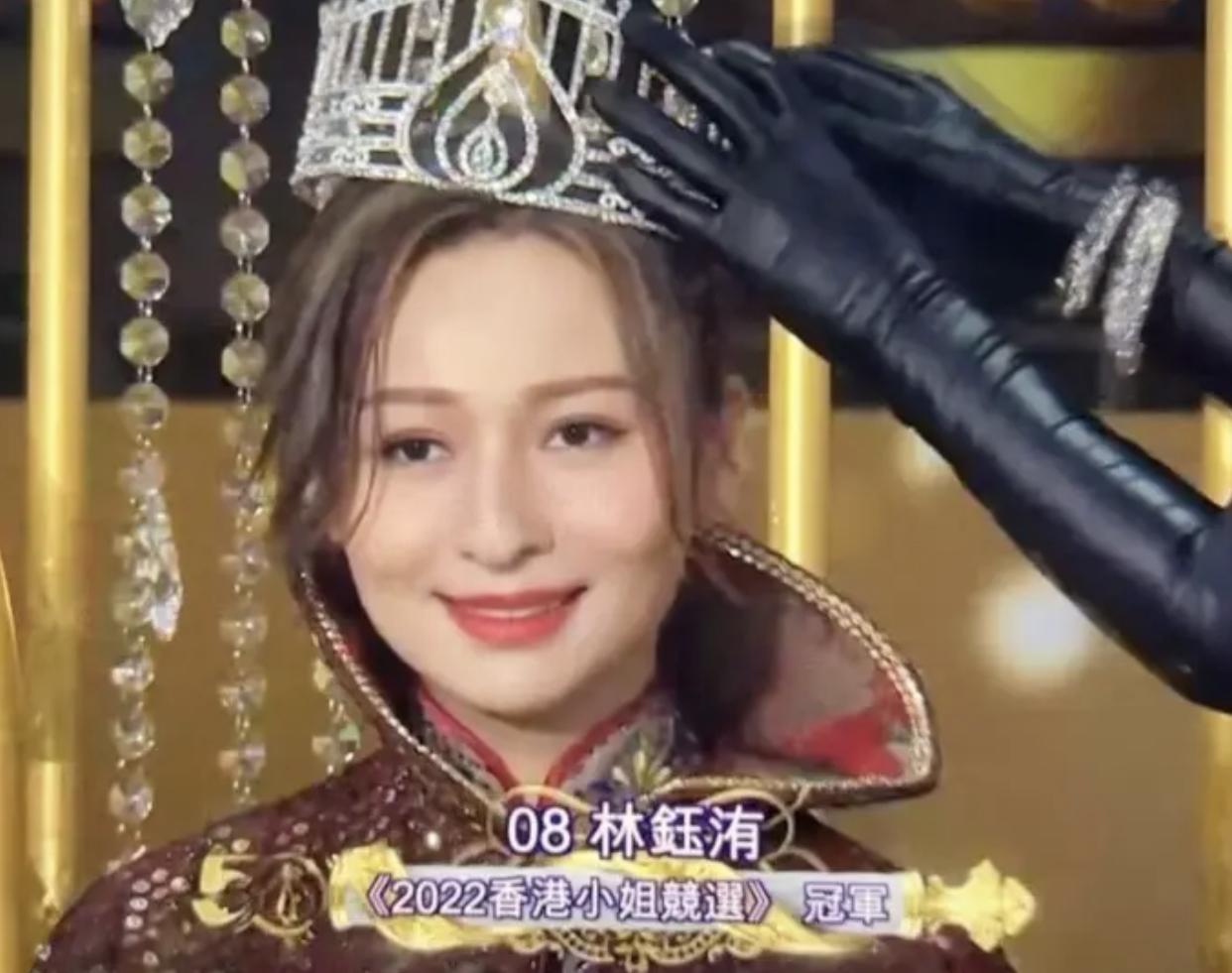 林俊贤|62岁知名男星疑被家暴！怀疑女儿非亲生，基因优秀获港姐冠军