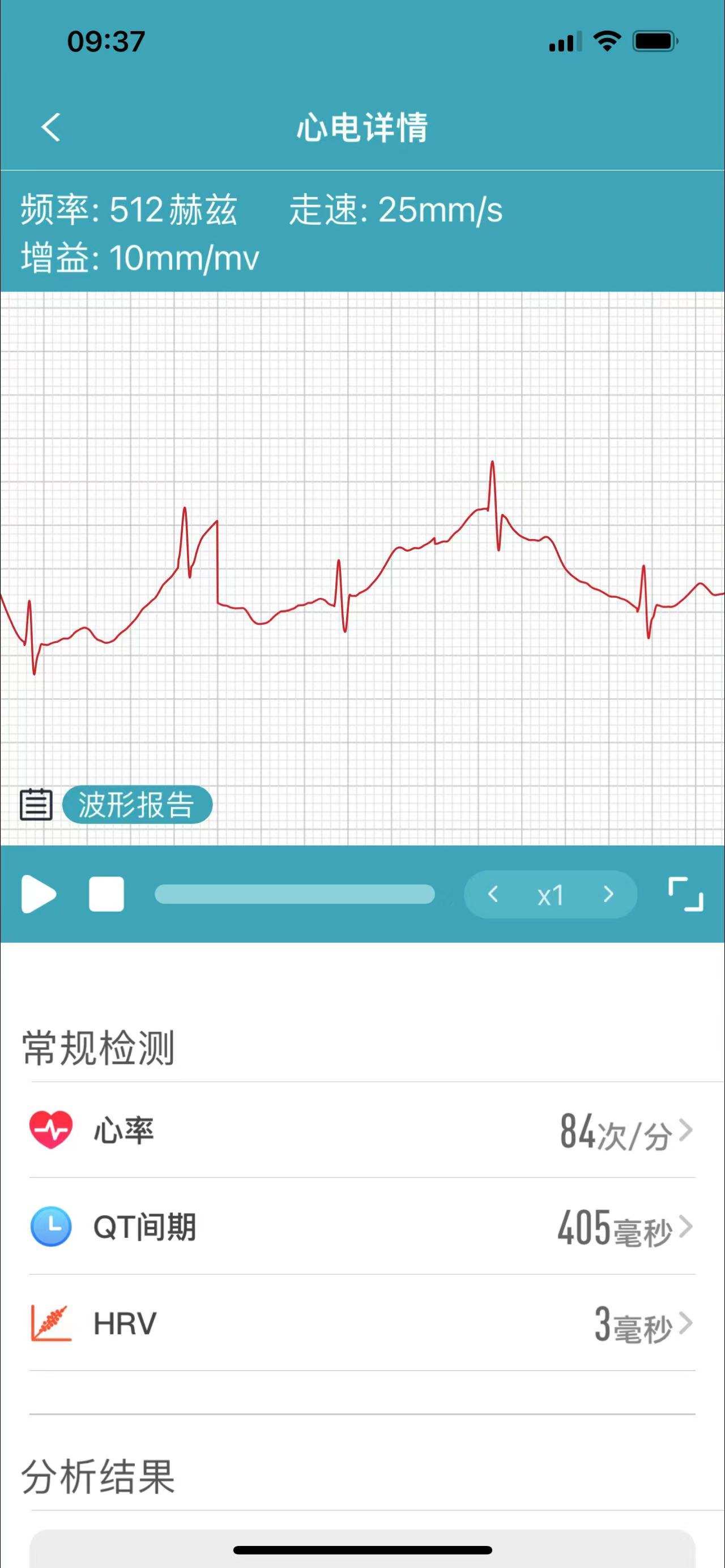 运营商|80、90后的健康新风向-dido G28S血压心电智能手表