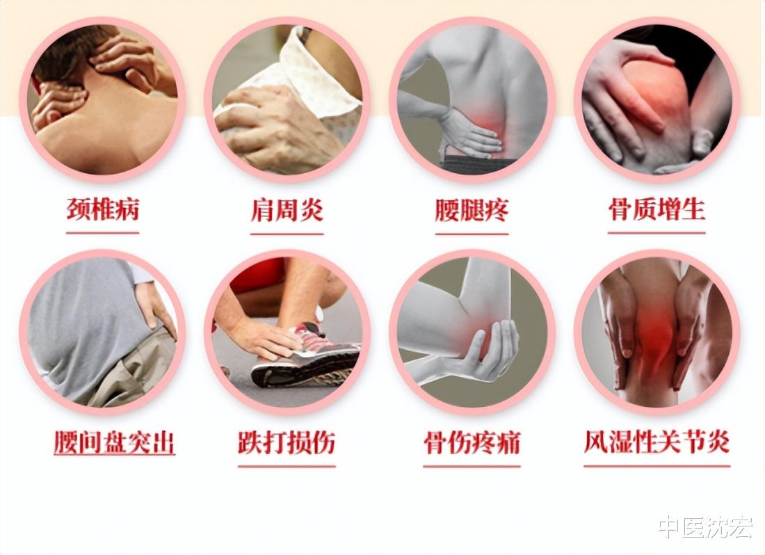 桂枝|5个厉害的中成药，逼出风寒湿，大补肝肾 温暖腰膝 横扫腰腿关节痛