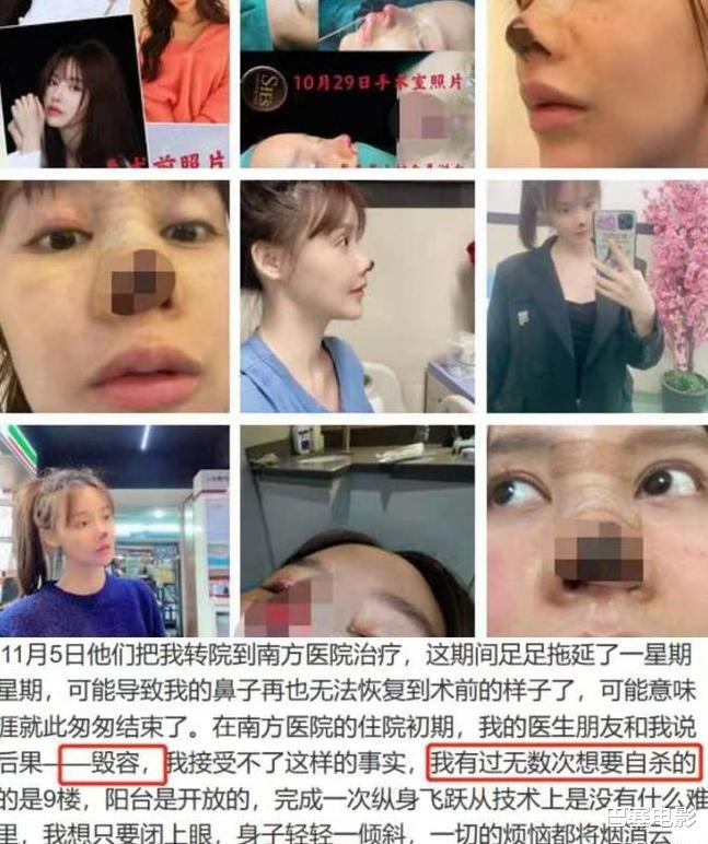 牛莉|好好的美女非去弄鼻子,林心如鼻子像被夹住,牛莉一个鼻孔两个大