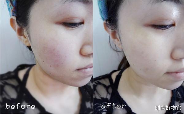 面霜|护肤课堂:什么是敏感肌?解决方法是啥?