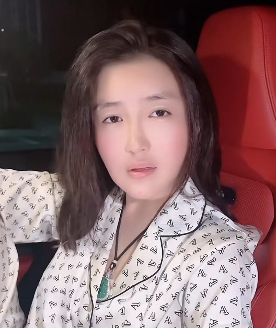 减脂 娇娇花2万植发，晒出视频太吓人，后脑勺秃一大片，自嘲是新发型