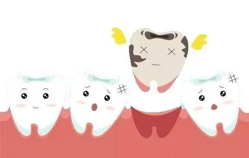 头孢|可引发牙痛的6大原因,平时一定做好口腔护理