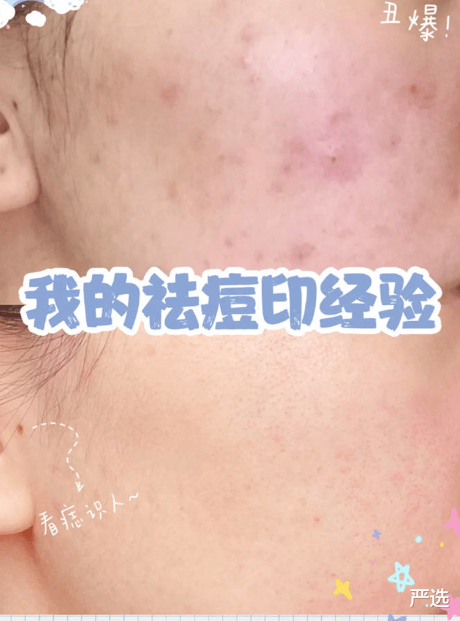 美食 她才31岁脸就崩了?从来不承认整容,如今满脸硅胶感垮成“假人”