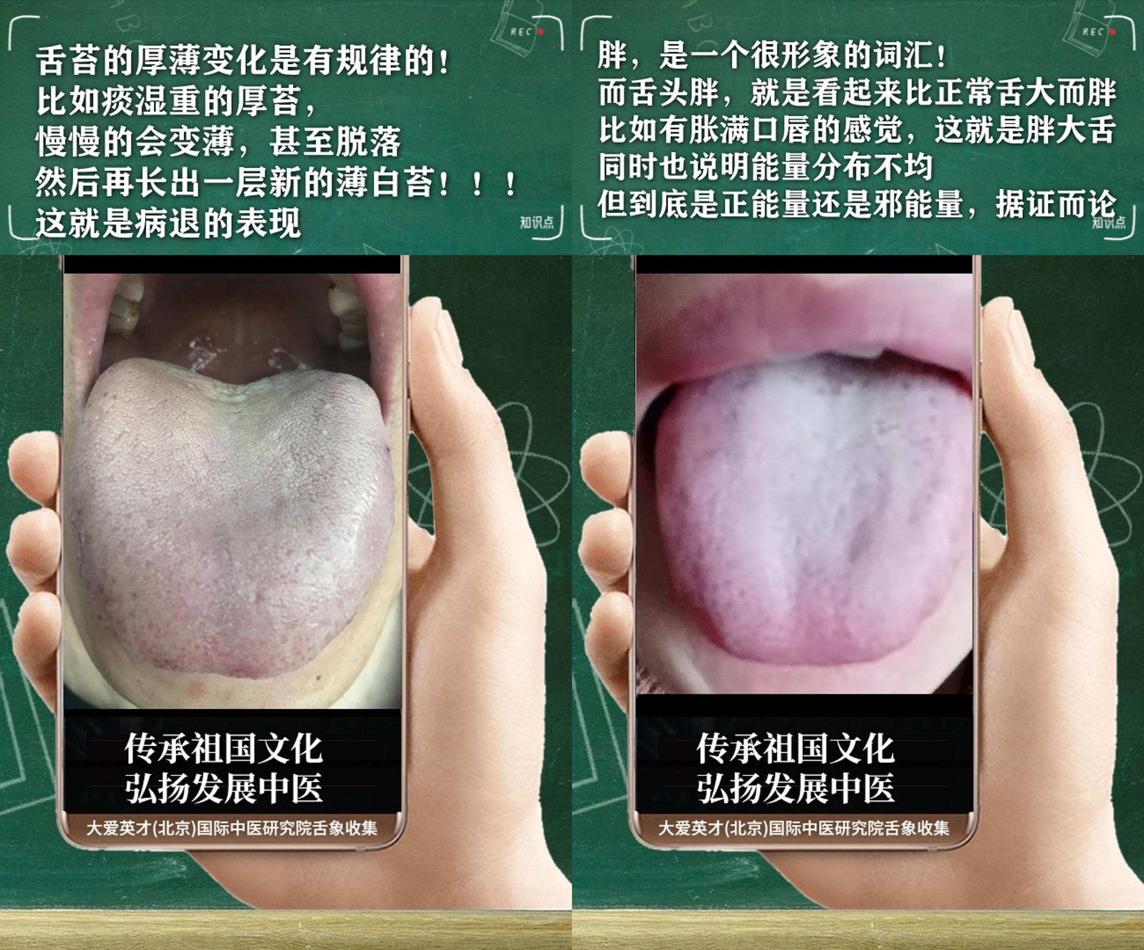 衰老|中医解剖:容易悲伤多虑,湿重痰多,反复胃胀,纳呆