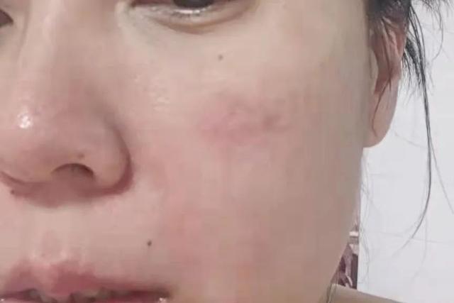 酵素 海报试用｜整天嚷嚷着要白，今天终于安排上了...