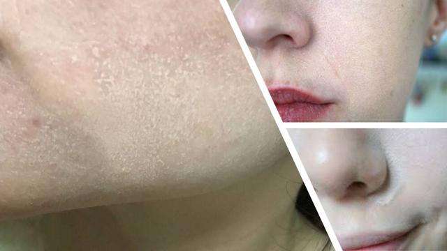 粉底液 有一种“尴尬”叫女星卡粉,高清镜头下妆容斑驳,细纹卡粉显老10岁