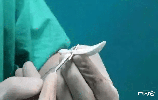 尿酸|整形不想变假人，这4点原则要记住！