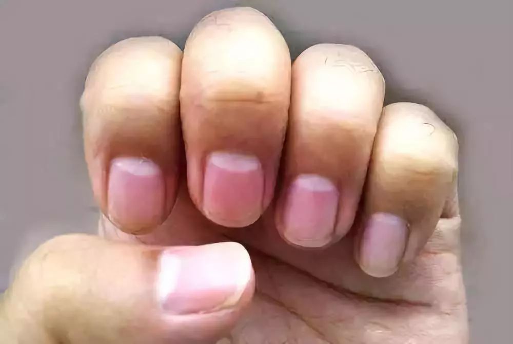 甲状腺结节|中医鬼才倪海厦：中医判断健康的十大标准