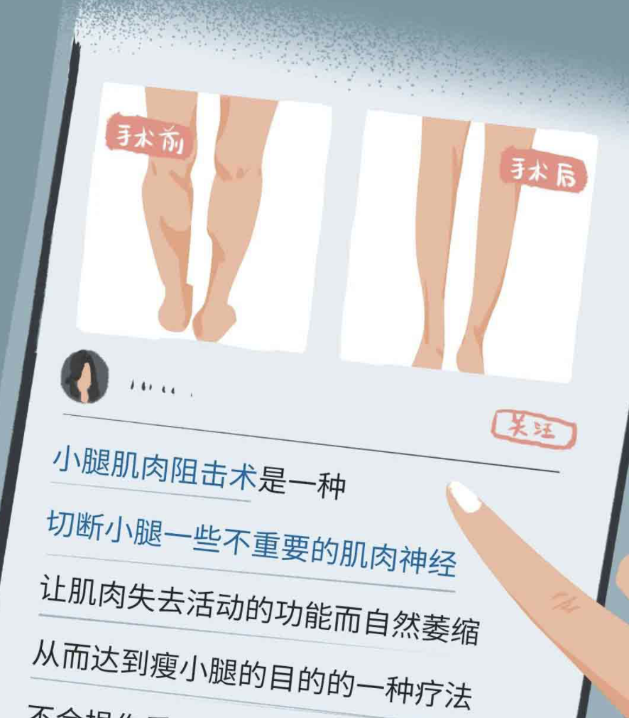 女孩 别人都是“白富美”吗？幸存者偏差，那些被误导的“直觉”