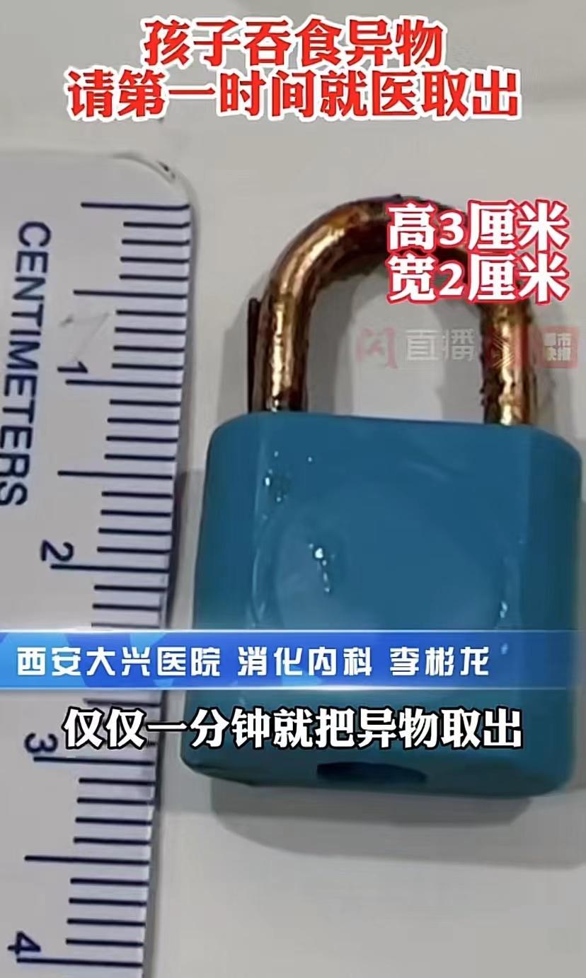 险失性命!五岁男孩吞食铜锁,父母指望自行排出九天未带其就医
