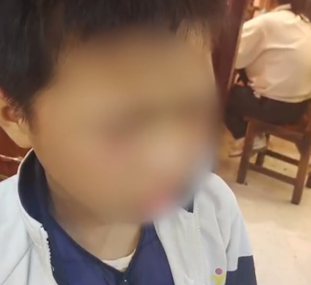 家长回应“领小孩上门道歉遭对方殴打”:儿子受伤严重,未进行调解,要求对方公开道歉