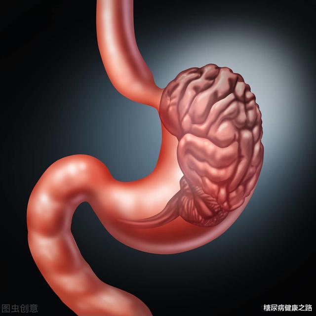 脂肪酸|为什么肠道健康很重要?哪些措施来改善?看看最新研究吧