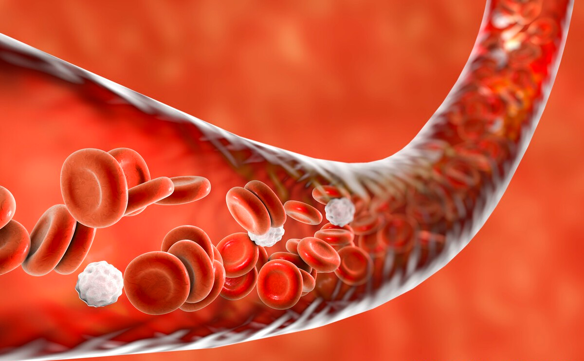 动脉粥样硬化|67岁大叔“斑块”消失，他坚持的4个养护血管的习惯，行之有效