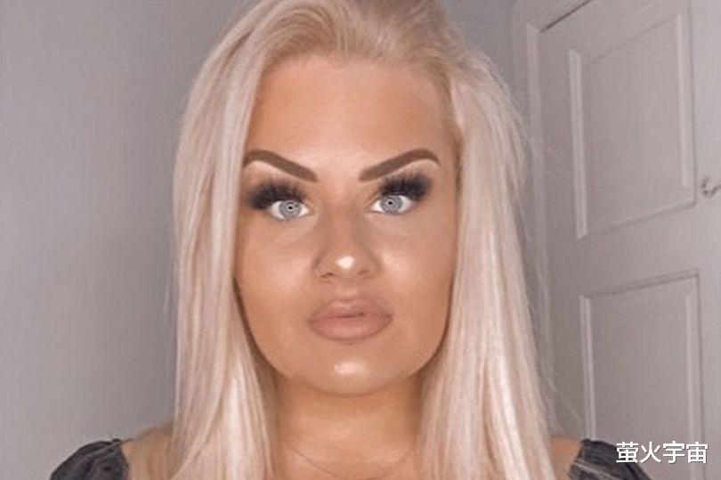 香肠 英国24岁女子第一次丰唇肿成“香肠嘴”,填充物膨胀到原来的20倍