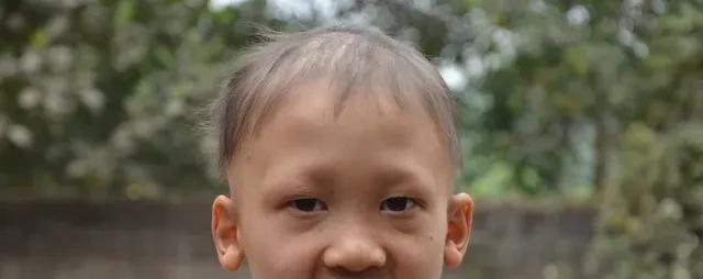 银屑病|越南有个怪村：全村人都没牙齿，每天刷5次牙都没用