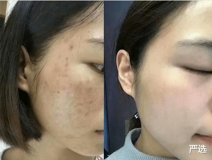 陈好 陈好“消失”近16年罕见露面，肌肤白皙细腻，素颜依旧“万人迷”