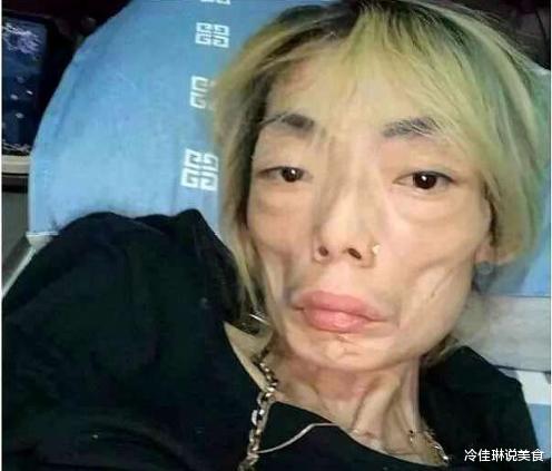 豪门|从名模到“怪物”，被豪门抛弃的伍智恒，42岁牙齿掉光全身瘫痪