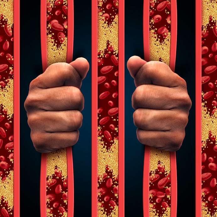 运动|查出高血脂,这4种食物要少吃,避免血脂飙升,需重视