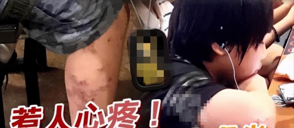 小小彬|小小彬正当红时赚1800万,长残后无戏可拍,如今得病皮肤溃烂