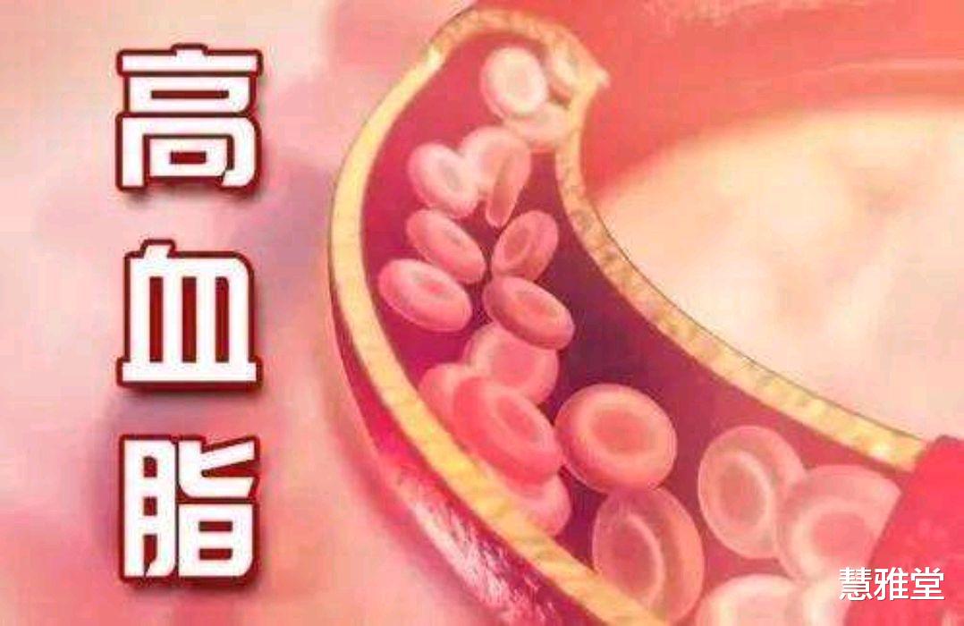 阿尔茨海默病|血脂升高了，身体会有哪些表现？高血脂有哪些危害？做3事降血脂