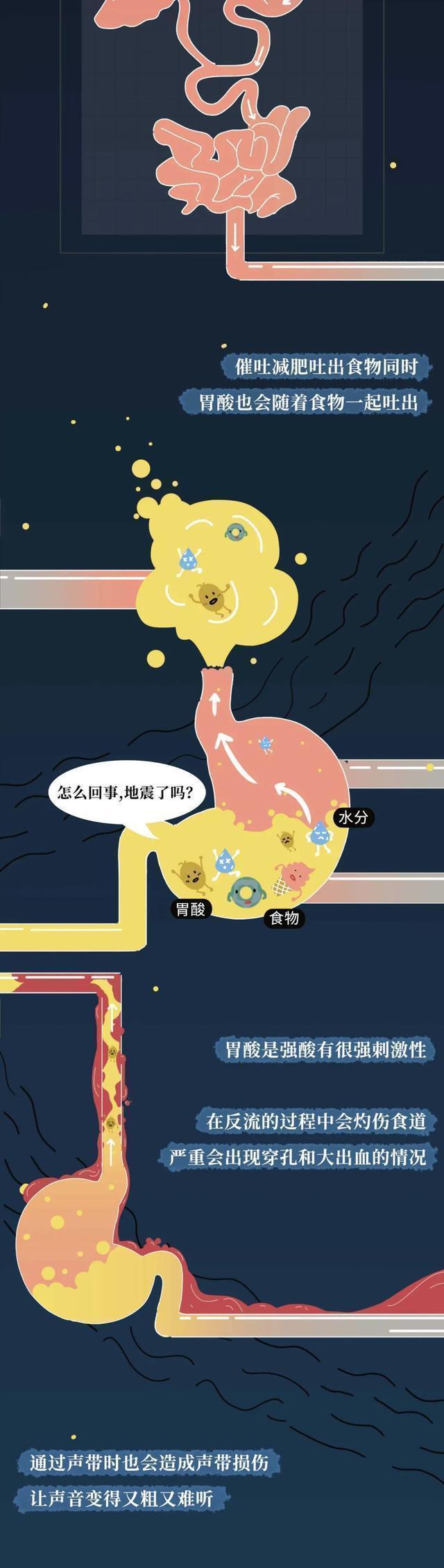 用“仙女管”催吐的女生是咋想的？这样做的后果她们知道吗？